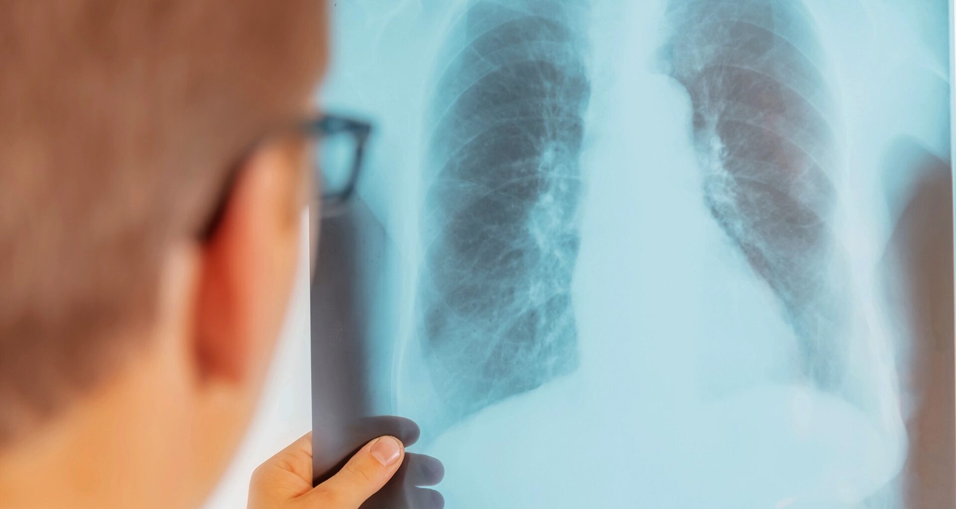 Metod kan upptäcka smittsam tuberkulos i utandningsluft