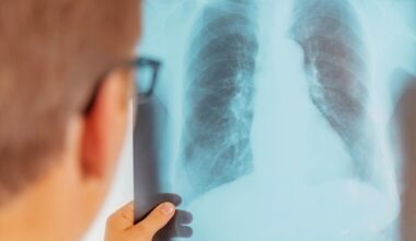 Metod kan upptäcka smittsam tuberkulos i utandningsluft