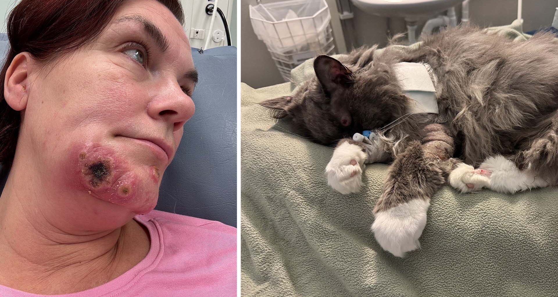 Åza smittades med kokoppor av sin katt