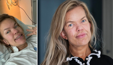 Sanna Dollan akut till sjukhus – opererades: ”Så läskigt”