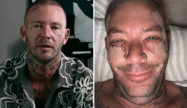 Joakim Lundell har skönhetsopererat sig