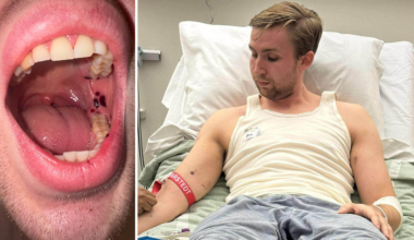 Kalle, 24, vaknade med blåmärken – var livsfarlig sjukdom | Handboll