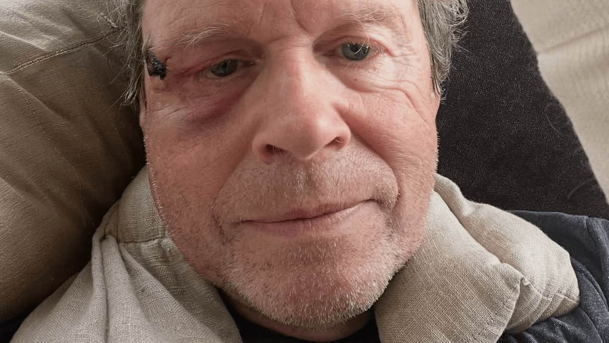 Tomas Gustafson: ”Då vaknade jag på akuten” | Sport