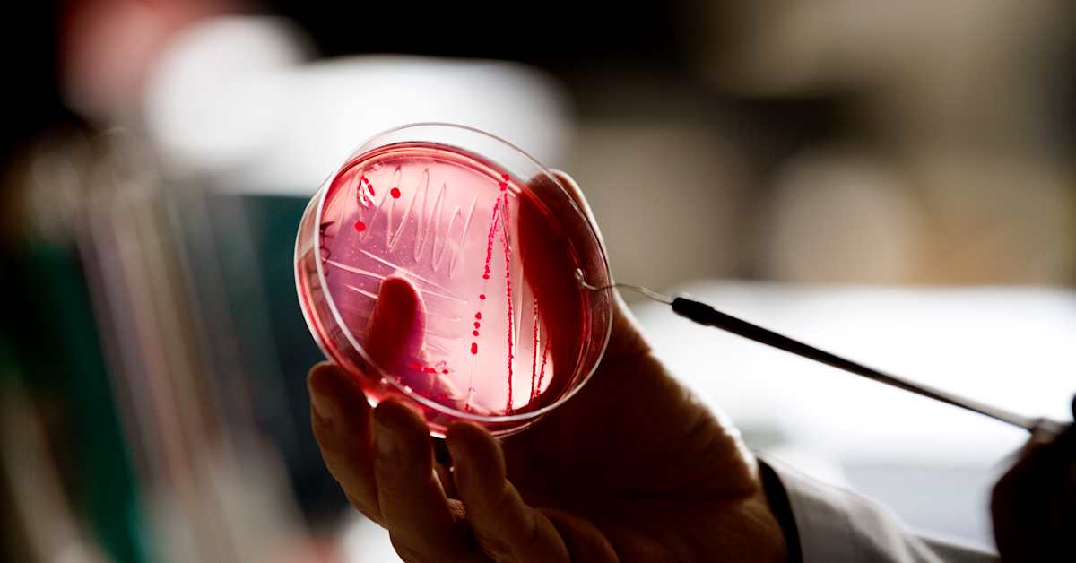 Antibiotika­resistens leder till miljoner dödsfall världen över varje år | Inrikes