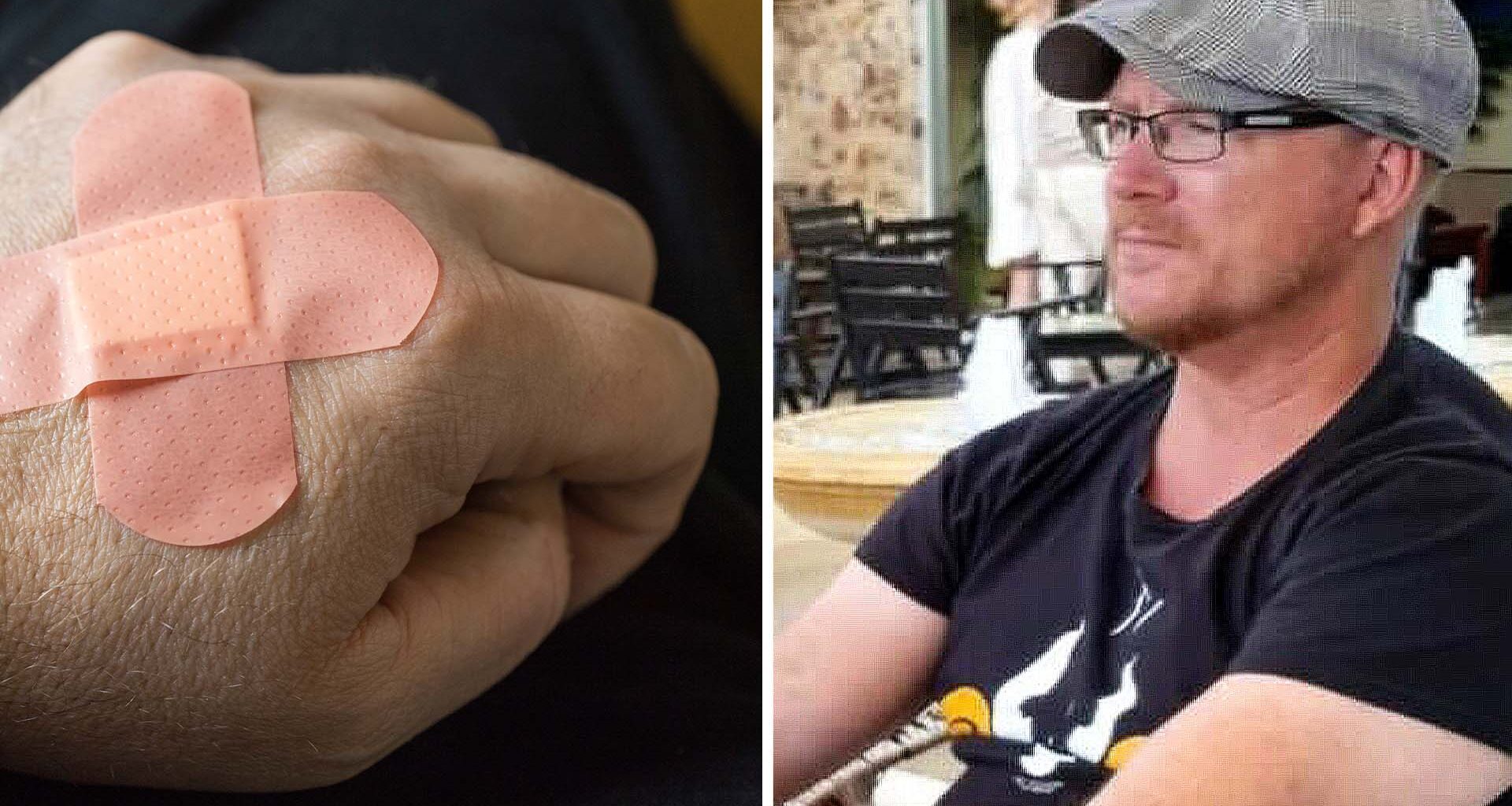 Mikael lider av den okända diagnosen ”skin picking”