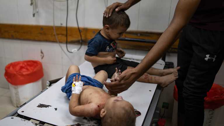 Två barn som skadats i ett krig finns på en bår på ett sjukhus. Den ena ligger ner, den andra sitter. Två händer sträcks mot dem för att stödja dem.