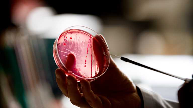 En person håller i en petriskål med ett prov, förmodligen bakteriekultur.