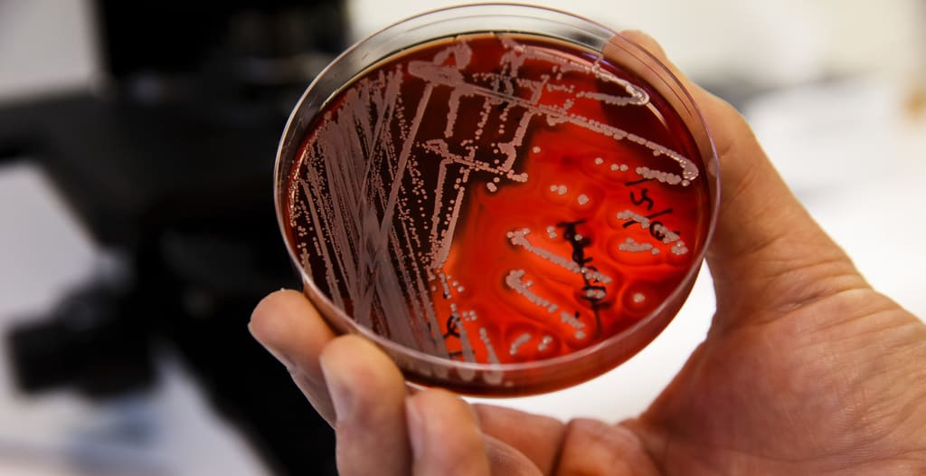 Snart fungerar inga antibiotika längre