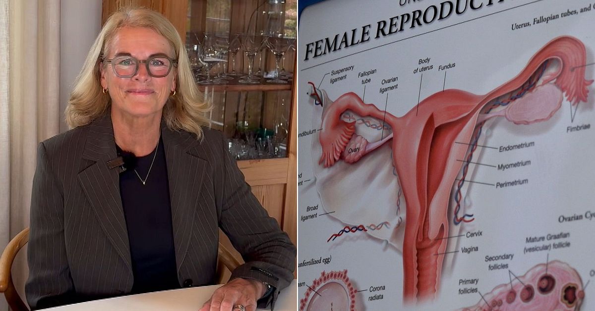 Så kan kvinnor få rätt hjälp för PCOS – forskare om ny studie: ”Ett genombrott”