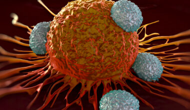 T-celler angriper en cancercell