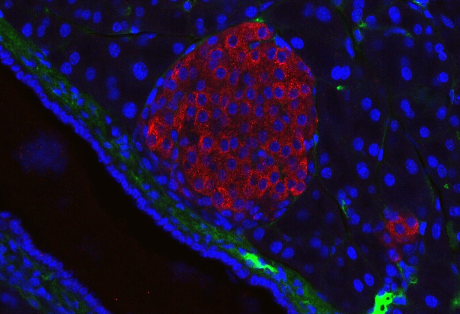 Ett nytt fönster för att studera de Langerhanska öarnas funktion