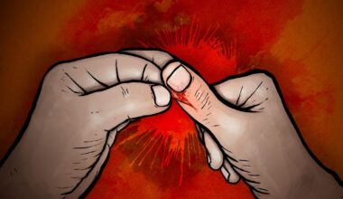 Dermatillomani, skin picking disorder, drabbar främst kvinnor – självhjälpstips