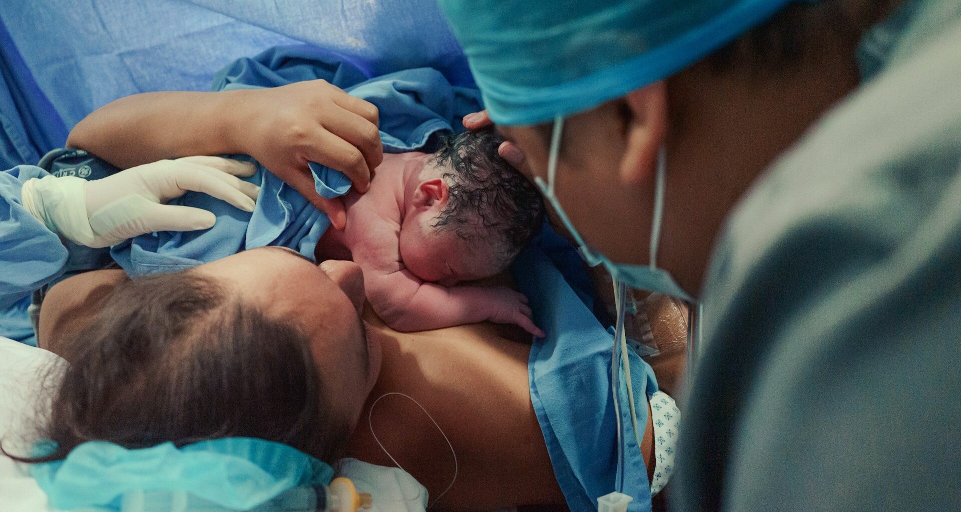 D-vitaminbrist ökar risken för komplicerade förlossningar