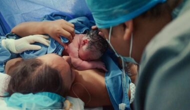 D-vitaminbrist ökar risken för komplicerade förlossningar