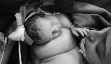 Tidig hud mot hud kontakt ger nyfödda en starkare start