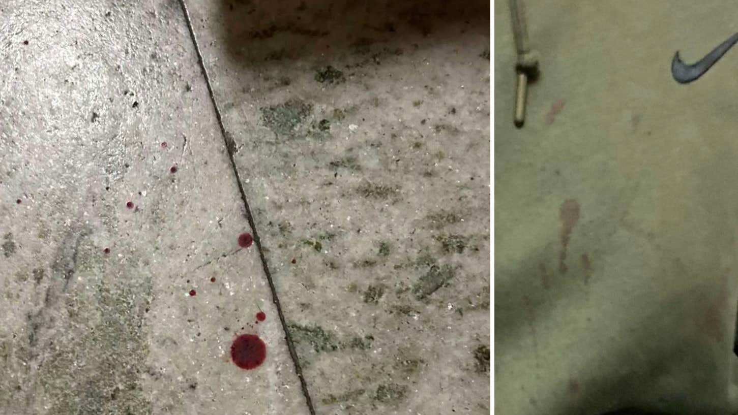 Kändisprofil frikänns från misshandel | Nöje