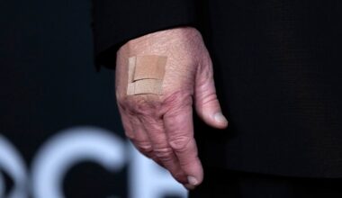 Donald Trump dyker upp med mystiskt plåster – spekulationer efter nya bilden