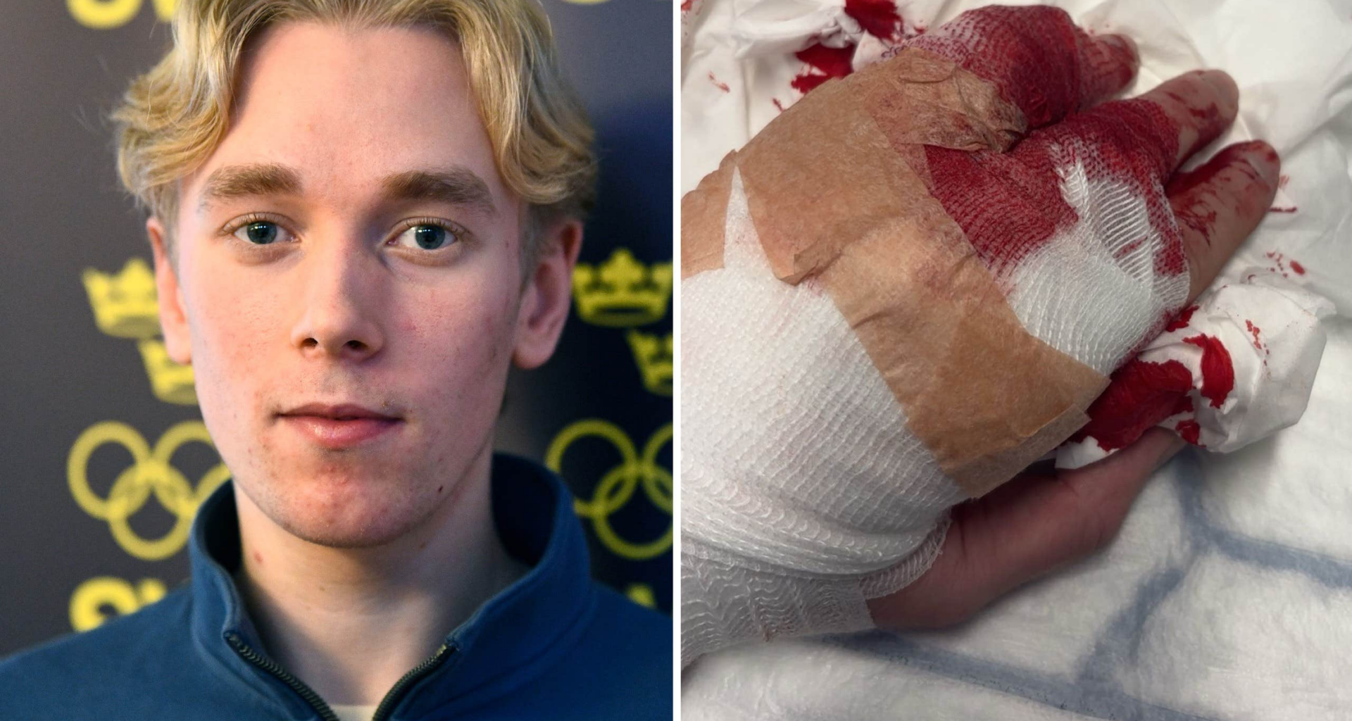 Andreas Nordebäcks skräckskada: ”Fingret hängde av” | Vintersport