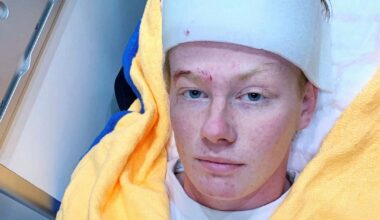 Maxim slogs blodig på jobbet.