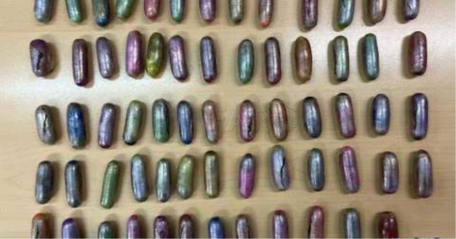 Röntgenbilderna på mannens mage visade ett stort antal kapslar i form av ekollon.