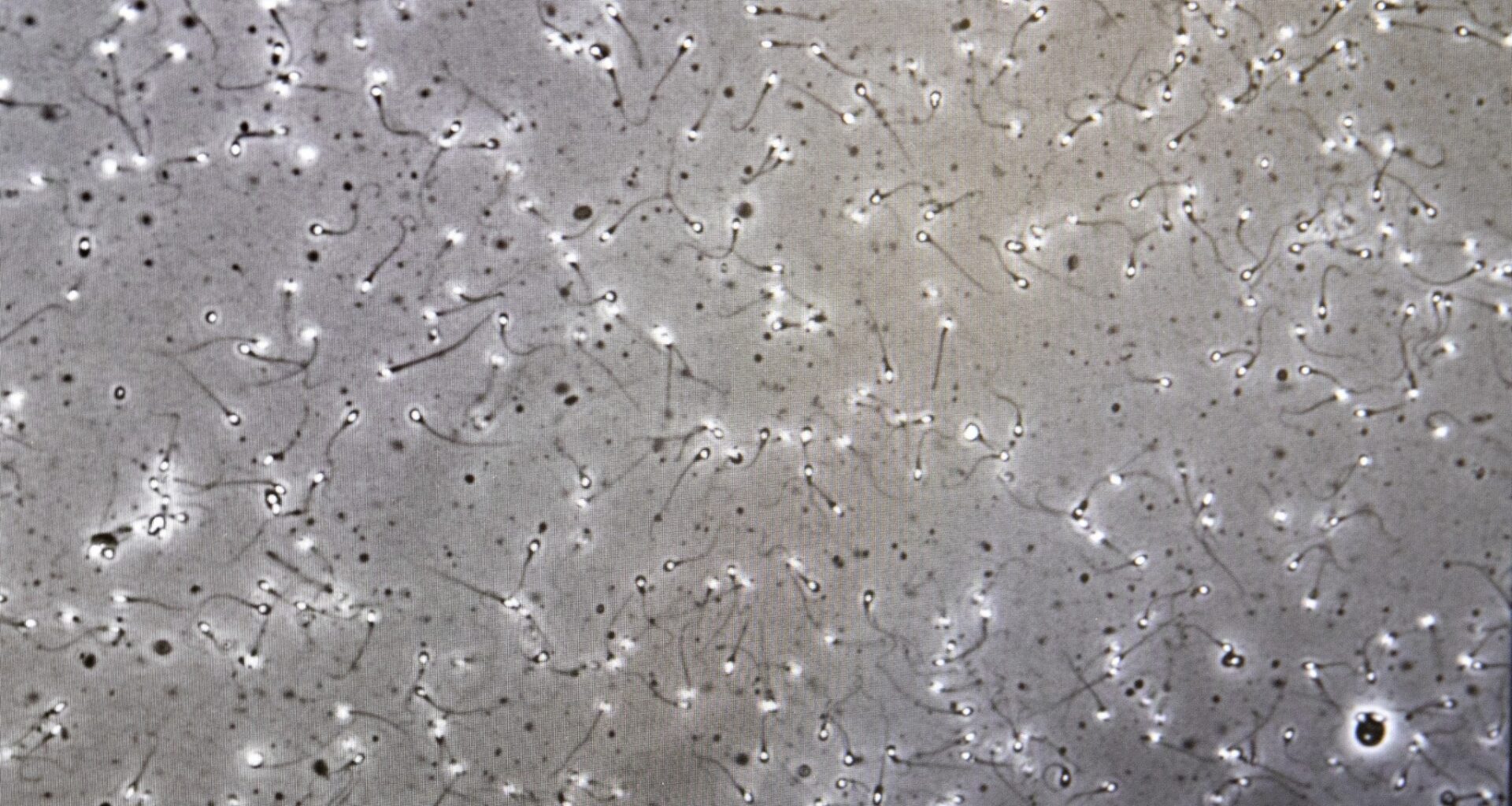 Drabbade i spermieskandalen kräver skadestånd från Region Halland: ”Viktigt att få upprättelse” - P1 Morgon