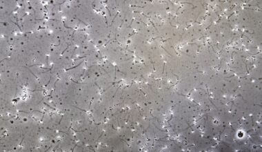 Drabbade i spermieskandalen kräver skadestånd från Region Halland: ”Viktigt att få upprättelse” - P1 Morgon