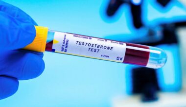 Läkare varnar för att ta testosteron