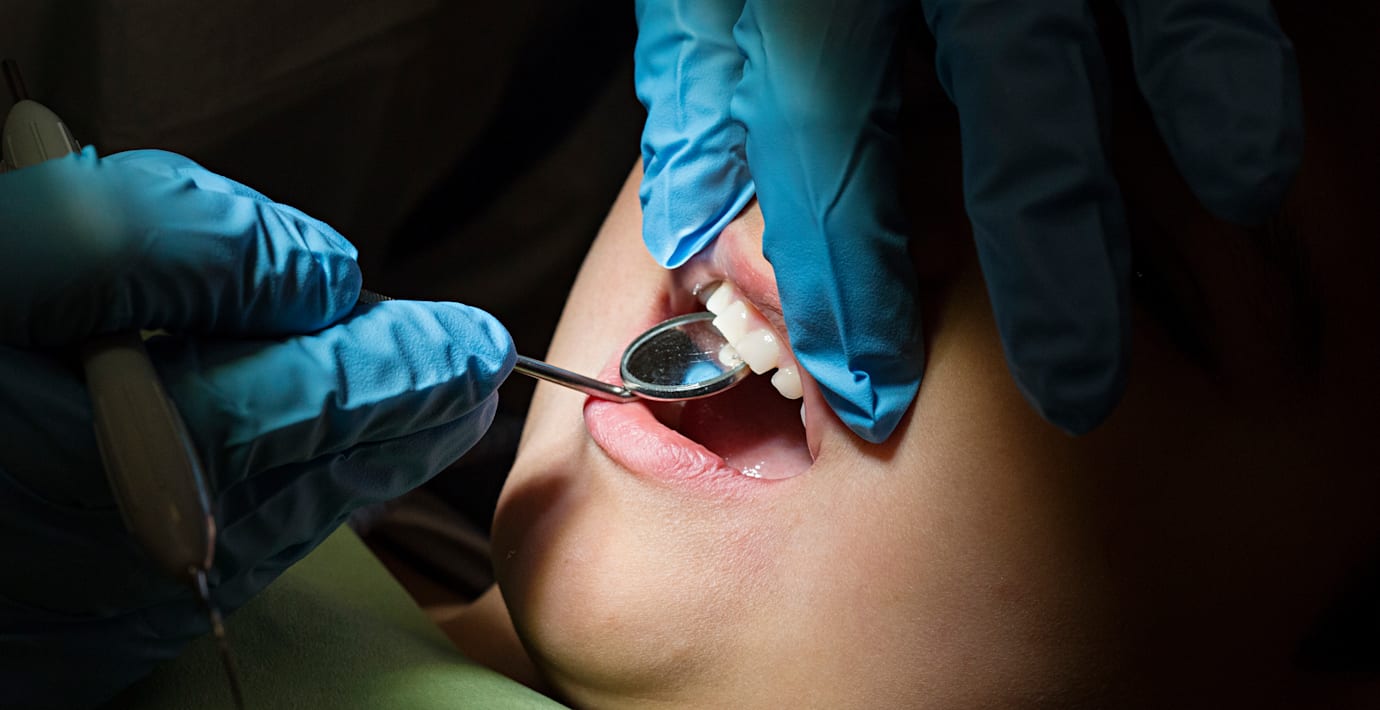 Tandläkare drar ut tänder i onödan