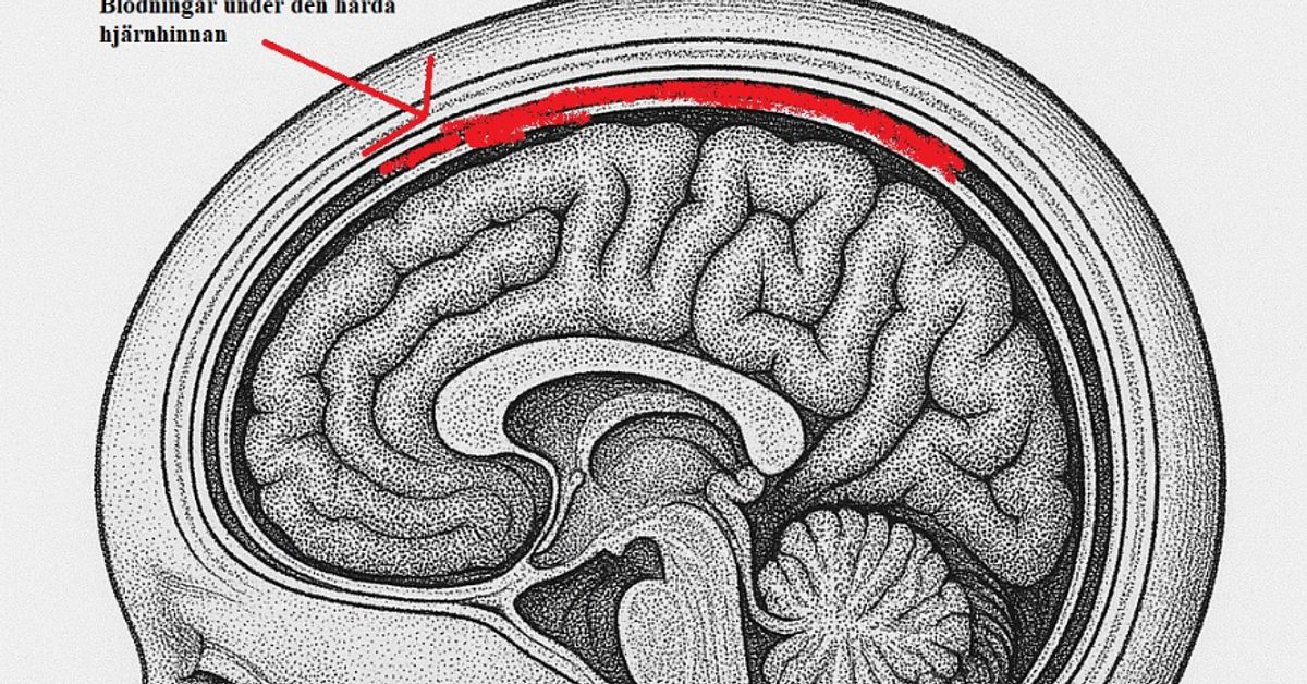 Föräldrar döms för vållande till kroppskada på spädbarn
