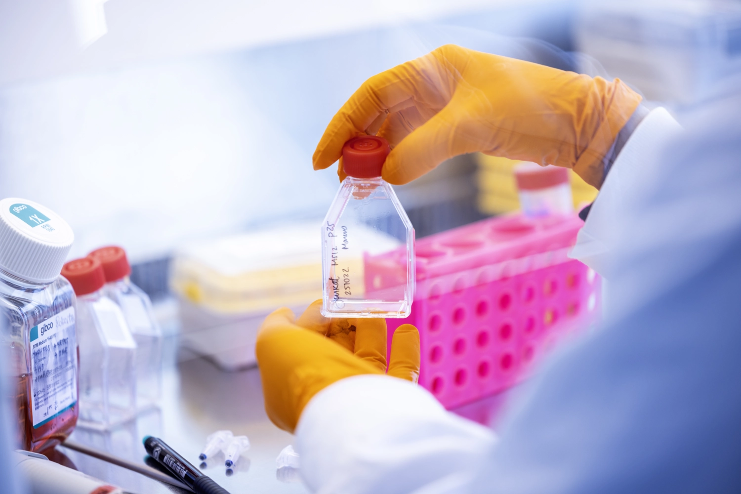 Nytt mikroprotein kan hjälpa cancerceller att övervinna stress