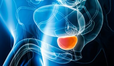 PSA-screening minskar dödligheten i prostatacancer enligt ny långtidsstudie