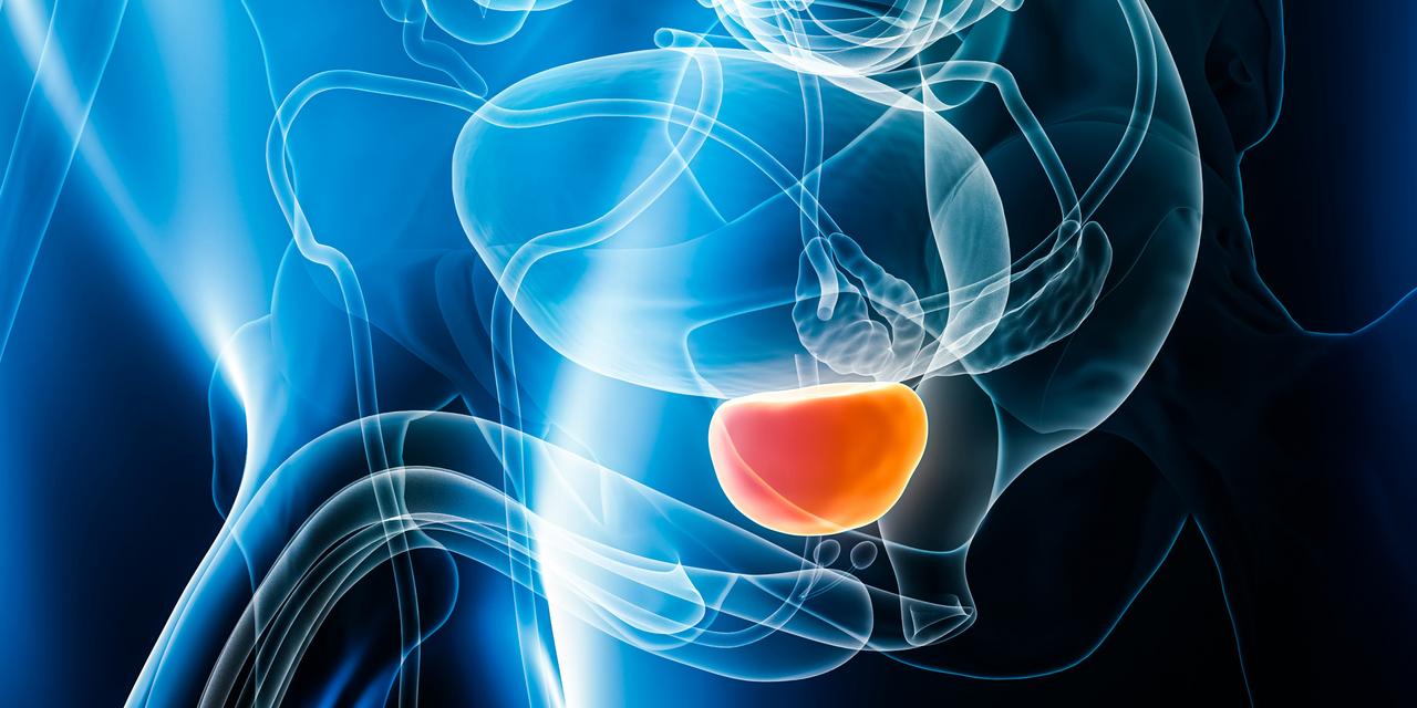 PSA-screening minskar dödligheten i prostatacancer enligt ny långtidsstudie