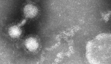 JUST NU: Smittsamt virus farligt för ny grupp