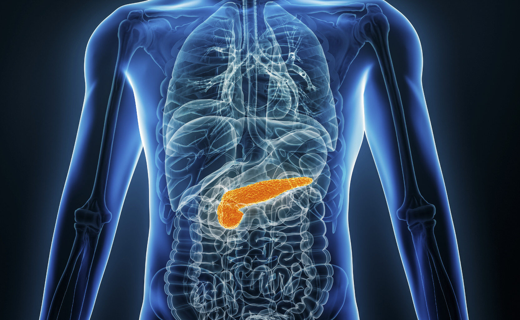 AI upptäcker cancer i bukspottkörteln