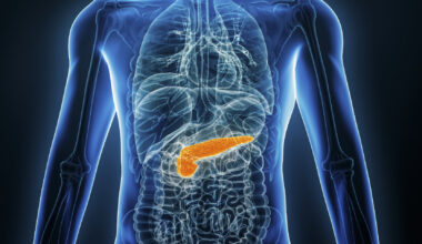 AI upptäcker cancer i bukspottkörteln