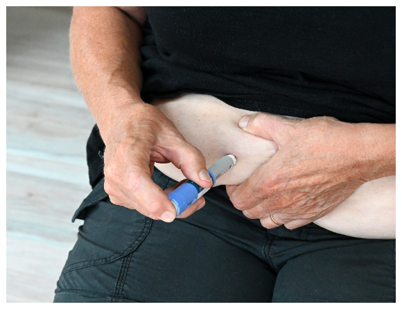 WHO efterlyser breddad tillgång till GLP-1-terapier