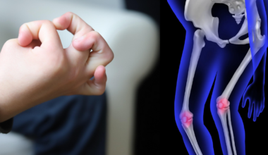 Studie finner inget samband mellan ledrörlighet, smärta och neuropsykiatriska funktionsnedsättningar hos barn