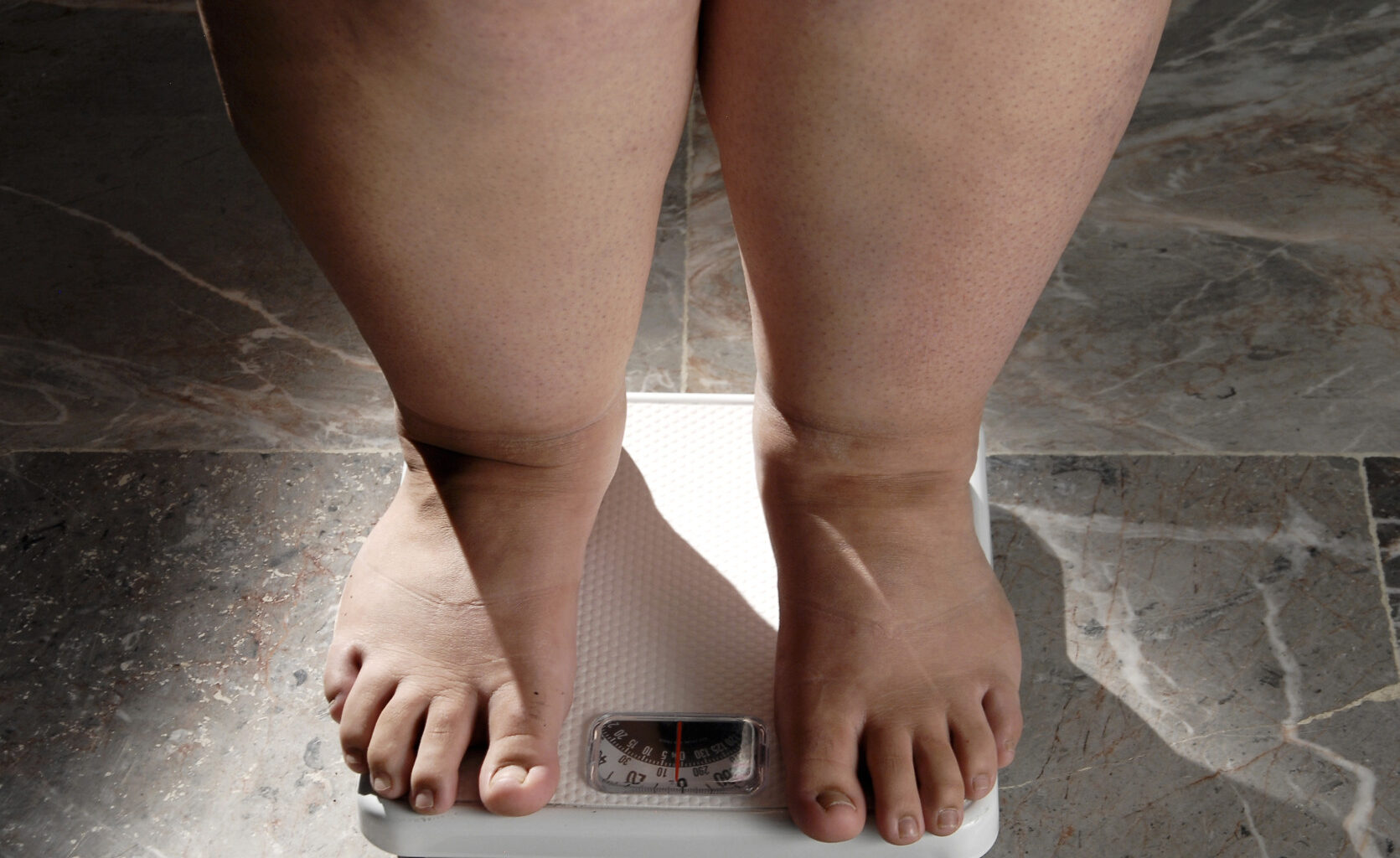 Första GLP-1-pillret mot obesitas godkänt i USA