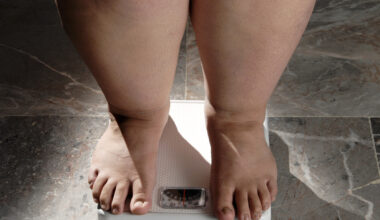 Första GLP-1-pillret mot obesitas godkänt i USA