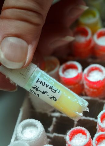 En hand håller en syrsörjande provrör med en gul vätska bland färgade provrör.