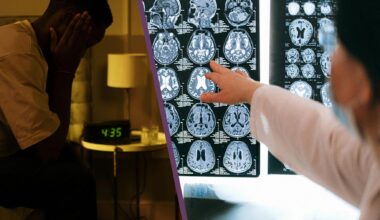 Dålig sömn kan få hjärnan att åldras snabbare.