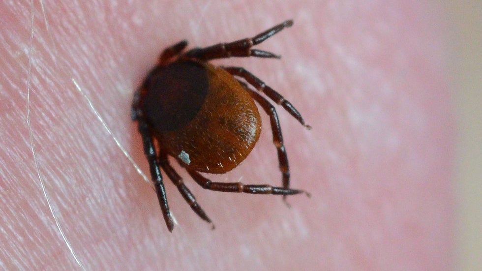 TBE är en virussjukdom som sprids av fästingar och kan innebära att smittade blir allvarligt sjuka. 