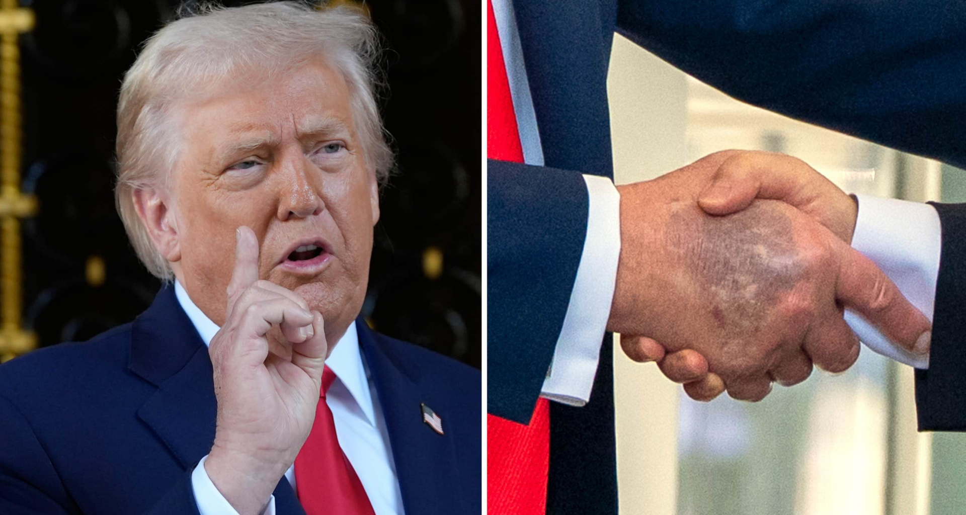 Trumps ord om sina blåmärken:
”Vill ha tunt blod”