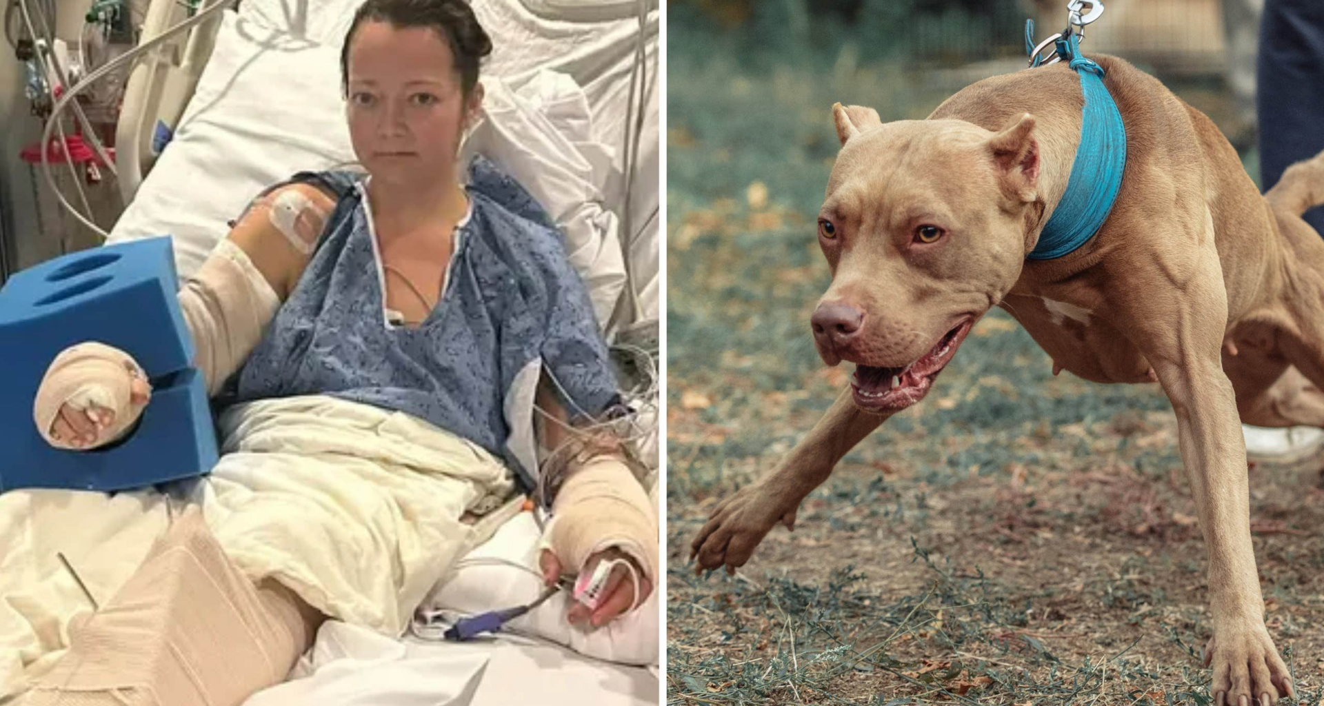 Attackerades av sin egen hund – tvingades amputera benet