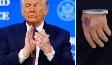 Bilden skapar
nya frågor om
Trumps hälsa