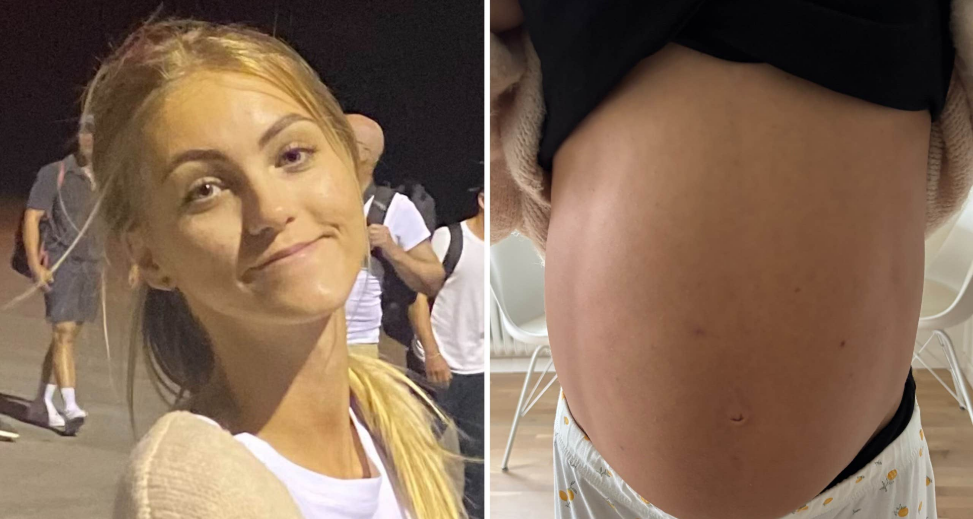 Nora, 22, avfärdades av vården – hade cysta på 10 kilo