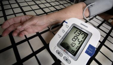 Så kan du minska risken att drabbas av stroke i förtid – Östersunds-Posten