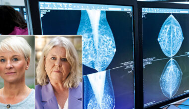 Äldre kvinnor ska inte behöva dö i bröstcancer