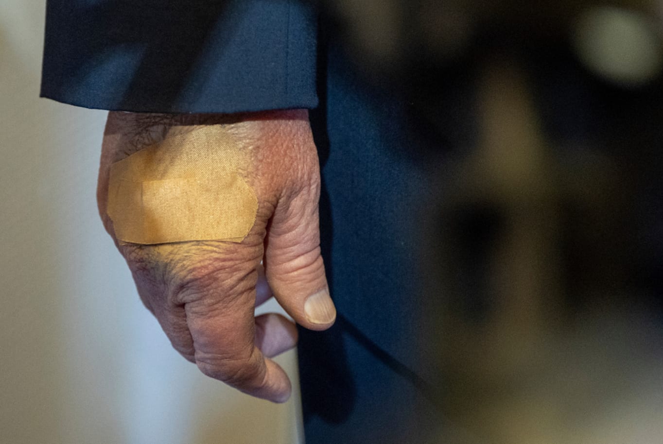 Trump har använt både smink och plåster på sin hand.