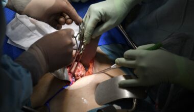 Minskande organdonationer skapar längre väntetider i Sverige